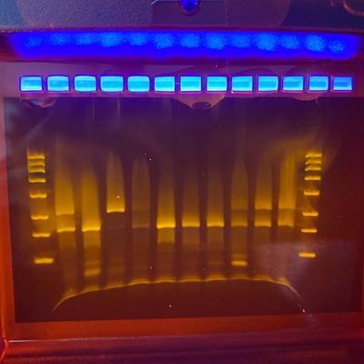 Ergebnis einer Gelenktrophorese